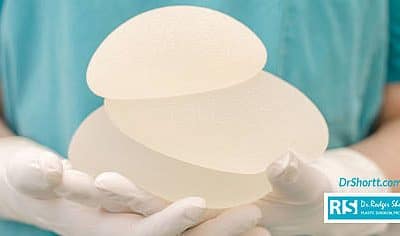 The Longevity of Breast Implants: Do They Have To Be Replaced?