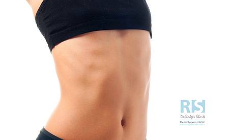 What is a Body Lift or Body Contouring Surgery? by Dr. Shortt