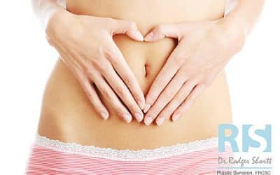 Belly Button Beautification – UMBILICOPLASTY